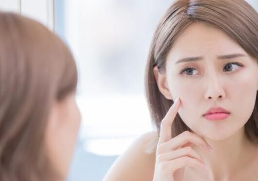 Clearer Skin Ahead: Modern Strategies for Managing Acne Breakouts